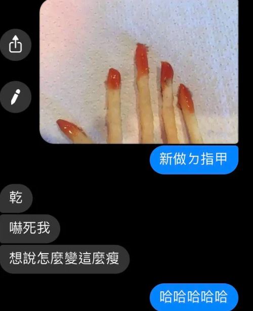 女友拿「薯條照」假裝新做的指甲 「敷衍系男友」秒回:超好看!% 照片 女友拿「薯條照」假裝新做的指甲 「敷衍系男友」秒回:超好看!
