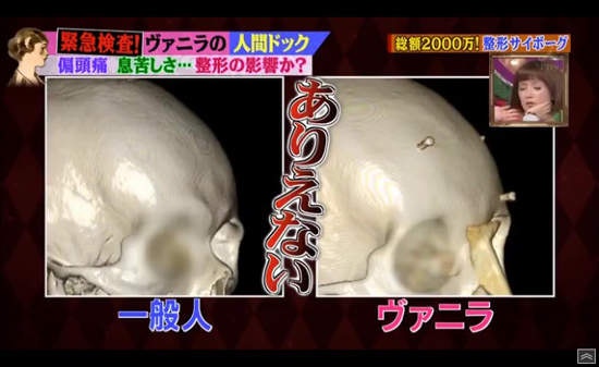 日女星「砸2億整型」被網友罵「腦袋有問題」 她公布背後原因:偽善會害死人!% 照片 日女星「砸2億整型」被網友罵「腦袋有問題」 她公布背後原因:偽善會害死人!